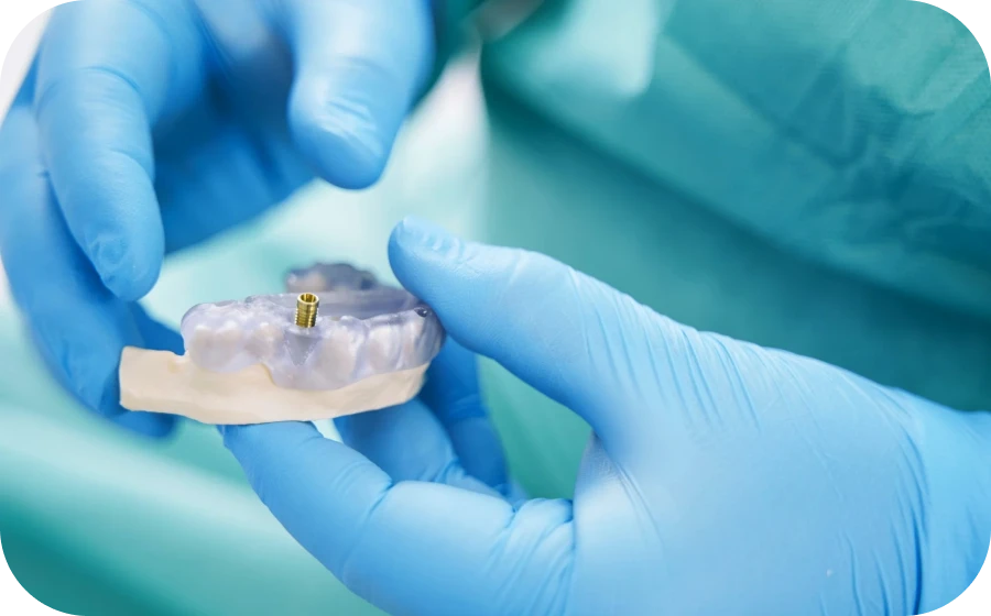 chirurgie-guidee-implantologie-teintureries-tarare