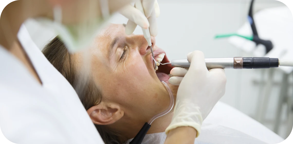 parodontologie-chirurgicale-tarare-centre-implantologie-teintureries