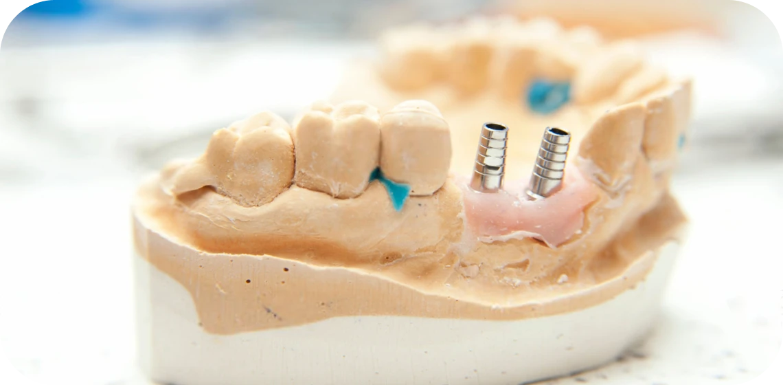 rog-centre-implantologie-teintureries-tarare