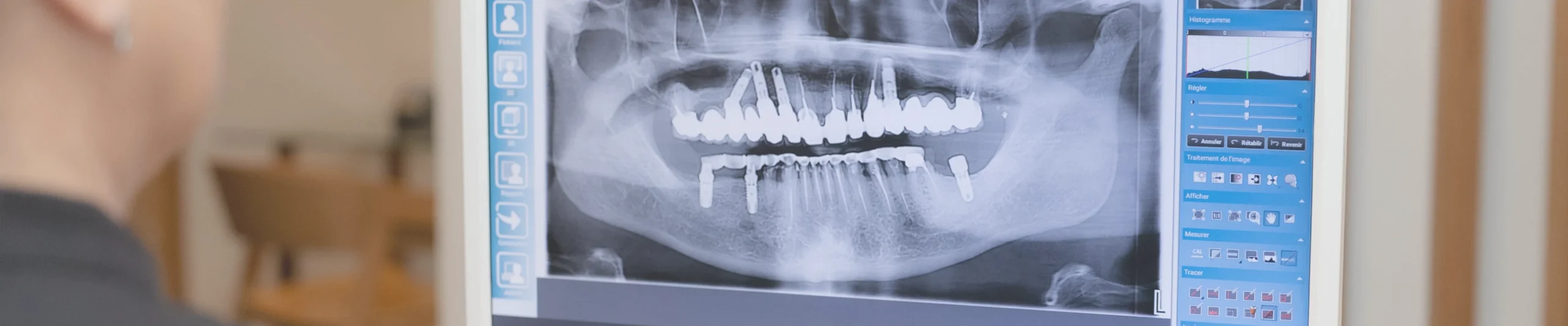correspondants-centre-implantologie-tarare